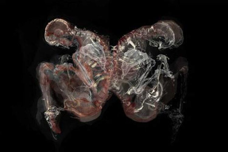 Frankenstein’s dream